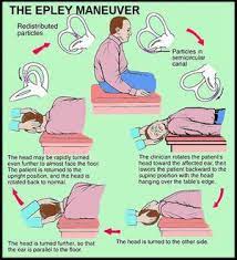 This necessitates the presence of a doctor. Benign Paroxysmal Positional Vertigo Wikem Vertigo Treatment Epley Maneuver Vertigo Exercises