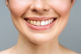 Image result for Tooth Discoloration