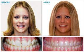 Pin On Extraordinary Results Before After