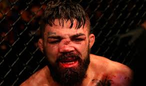 Las cinco peores “narices rotas” en la historia de la UFC