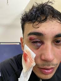 V for Vinegar (@Vakuravy)