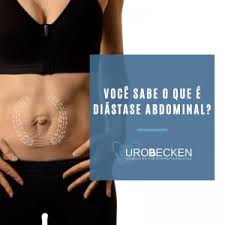 O Que E Diastase Abdominal Como Saber Se Tenho E Qual Tratamento