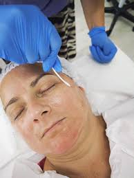 #Cursul de #cosmetician #calificare, #Styllia #Class, Peeling-ul chimic  este o procedură din cosmetica modernă care se predă cursantelor în  perioada octombrie