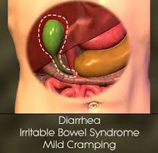 Gallbladder Removal Side Effects Gallbladder Surgery After Gallbladder Surgery Gall Bladder Removal