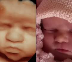 Uma feliz antecipação😍 É até engraçado falarmos que estes antes e depois  se parecem tanto com o bebê! Sim, claro, se parece porque é o bebê mesmo😁.  Mas ainda sim é incrível