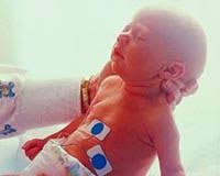 Assessments For Newborn Babies