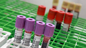 Https Weather Com De De Deutschland Wettervideo Video Erneut Trocken In Deutschland Nur Einer Region Droht Starkregen Https V W X Co De Sonne Regen Mai Jpg Erneut Trocken In Deutschland Nur Einer Region Droht Starkregen Hochdruckgebiet Falk