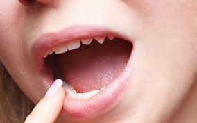 Maybe you would like to learn more about one of these? Vitamin Ini Bikin Gigi Kuat Setiap Saat Okezone Lifestyle