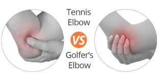 tennis elbow and golfers elbow whats the difference