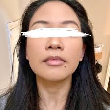 TOP 10 BEST Facials With Pore Extraction in Henderson, NV