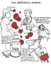 Here are the signs you might have iron deficiency and how to meet your daily intake. 5 Pearls On Iron Deficiency Anemia Core Im Podcast