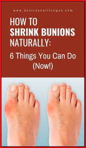 Pin On Home Health Remedies
