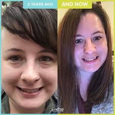 Scientist have known for a hundred years that light, even ordinary light has an effect on cell function and that light deprivation can trigger. 2 Years Of Hair Growth Having Short Hair Was Fun For A While But I Can T See Myself Going Back To It Love Having Lo Hair Again Short Hair Styles Hair