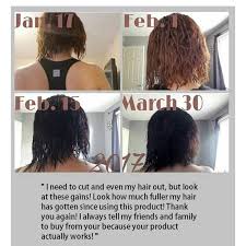 Type 'hair growth tips' on google and you will get a lot of products, tips and tricks that guarantee hair growth. Formula D Hair Regrowth Serum Good For Ccca Baldspots Bigchop Hair Growth Oil For All Hair Types Teens Kids Breakage Fast Acting Hair Growth Tips Grow Hair Hair Regrowth