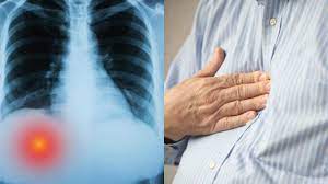 Most often pain under right rib cage may be a symptom of an injury or inflammation to any of the organs located in the abdomen cavity under the. Here S What It Means If You Have Pain Under You Right Rib Cage
