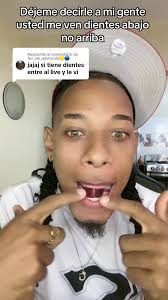 Risas sobre prótesis dentales en el Live