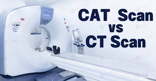 Image result for Cat Scan