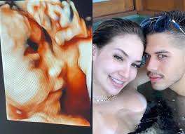 Check spelling or type a new query. Ze Felipe Mostra Rosto De Filha Com Virginia Fonseca Em Ultrassom Quem Quem News
