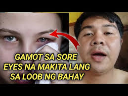 alternatibong gamot para sa sore eyes, sobrang effective makikita lang sa  loob ng bahay
