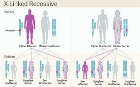 Lesch Nyhan Syndrome Causes Symptoms Treatment Life Expectancy