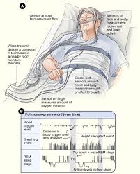 Image result for Actigraphy