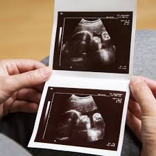 Maybe you would like to learn more about one of these? Doktor Dedahkan 6 Punca Air Ketuban Kurang Kalau Tidak Terkawal Boleh Jejaskan Janin Pa Ma