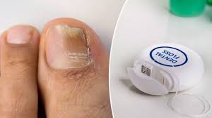 home remes to treat ingrown toenails