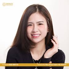 Dáng răng thỏ vuông là gì? Tại sao lại hot trend?