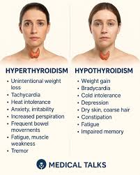 Image result for Hyperthyroidism