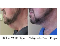 What is aesthetic medicine · physical surgery, which is done on the body, usually the face, to enhance the patient's current appearance. Before After Cosmetic Surgery Medical Face Body Aesthetics