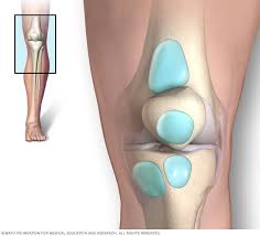 Image result for Prepatellar Bursitis