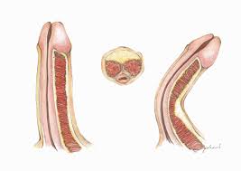 Maybe you would like to learn more about one of these? Urologo Alicante Consulta De Urologia Urologist Dr Leonardo Tortolero