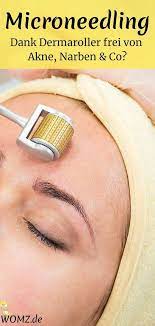 make microneedling yourself with the dermaroller that 39 s how it works dermaroller microneedling that39s works dermaroller akne hautpflegeprodukte