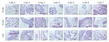 Study Of Viral Vectors In A Three Dimensional Liver Model Repopulated With The Human Hepatocellular Carcinoma Cell Line Hepg2 Protocol Translated To Arabic