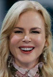 When people have had too much what's called neuromodulator, that goes by different brand names like botox, xeomin, and dysport. Nicole Kidman Lips Plastic Surgery