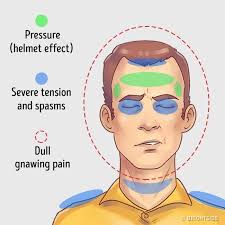Resultado de imagen para headache