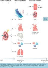 Image result for Postrenal Failure
