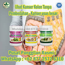 Peringkat awal kanser usus mungkin tidak menunjukkan gejala, tetapi apabila polip mula membesar menjadi tumor. Storymapjs Sebaris Gejala Awal Kanser Kolon Yang Sudah Tahap Lanjutan