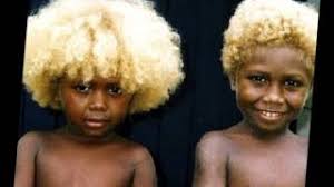 Once you get into blonde highlighting, it might be hard to stop. Black People With Natural Blonde Hair Everything Is Possible In Genetics Thasso
