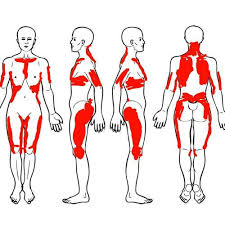 Image result for Tender Point