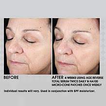 The exuviance performance peel ap25, along with the entire exuvinace line is 30% off during ulta's 21 days of beauty sale until september 21st. Exuviance Anti Aging Skin Care Products Hsn