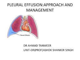 Pleural effusion develops when more fluid enters the pleural space than is removed. Pleural Effusion