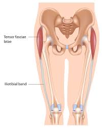 Image result for Snapping Hip