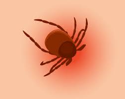 Lyme Disease Specialist Hoboken Nj Avisheh Forouzesh Md Infectious Disease Specialist Advanced Infectious Disease Medical