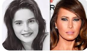 She's fabulous. I look rounded face when young and now I hand chic bones  and all. Never did anything. She's stunning to me at 56.