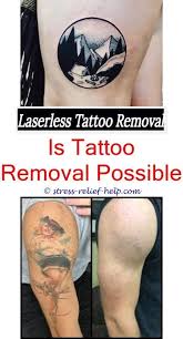 Most especially, these said advancements in tattoo removing services have been bustling in nyc. Fade Fast Tattoo Removal How Much Is Tattoo Removal In Nyc Tattoo Removal Cream Before And After Tattoo Removal 9 Tattoo Removal Cost Tattoo Removal Tattoos