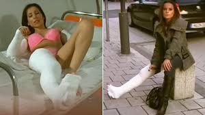 Long Leg Casts: The Ultimate Adult Industry Fetish