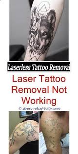 It's unlikely that your tattoo will be completely removed. Tattoo Paper Wie Erkennt Man Ob Die Entfernung Von Tattoos Infiziert Ist Ist Picosure Die B Doar