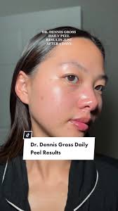 Dr Dennis Grows Universal Daily Peel