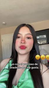 Admiring Guys with Braces